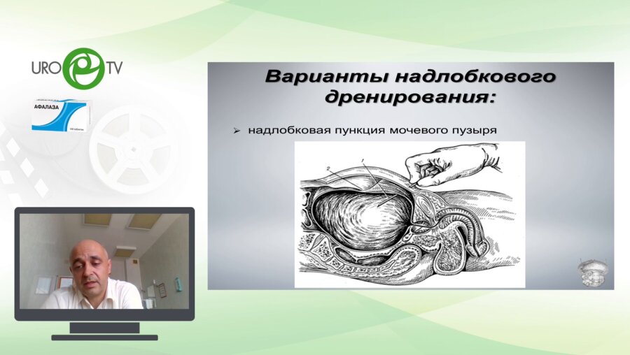 Шкодкин С.В. - Цистостома: установка, уход, прогноз