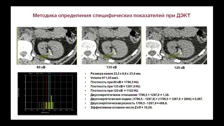 Капанадзе Л.Б. -  Современные лучевые технологии в диагностике МКБ