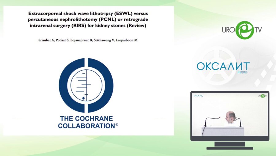 Малхасян В.А. - Камень в нижней руппе чашечек 1,5 см - ДПТ против РИРС