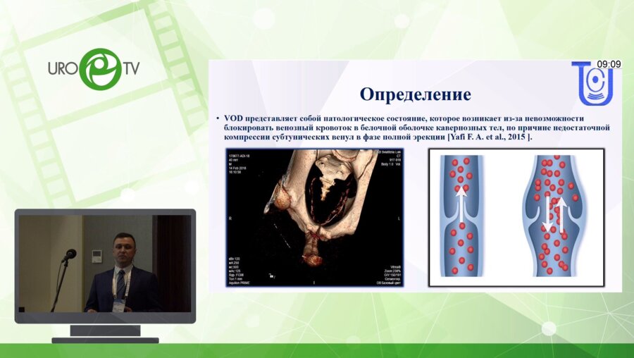 Гринь Е.А. - Собственный опыт применения динамической мультиспиральной компьютерной фармакокавернозографии