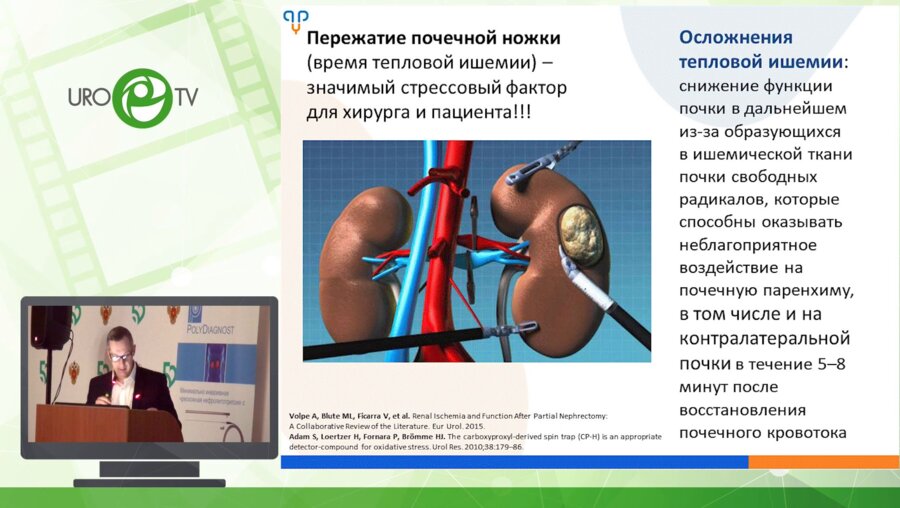 Дорончук Д.Н. - Лапароскопическая лазерная резекция почки