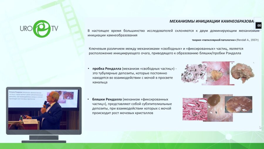 Саенко В.С. -  Консервативная терапия - альтернатива оперативному. Возможно ли это