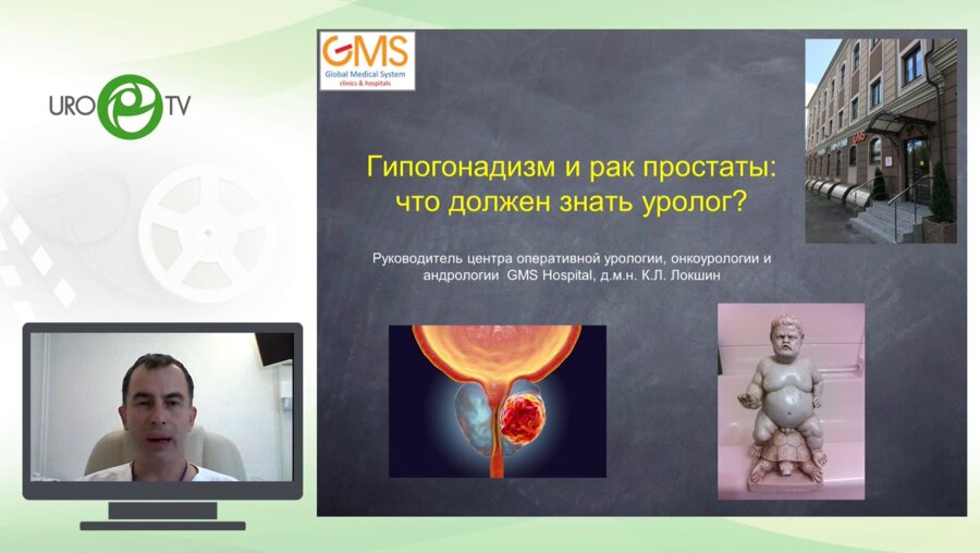 Локшин К.Л. - Гипогонадизм и рак простаты: что должен знать уролог?