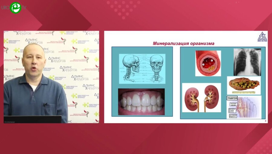 Губанов А.И. - Комплексный анализ состава мочи и уролитов - ключ к выбору стратегии лечения мкб