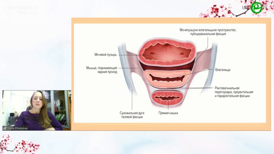 Ефремова Е.С. - Функциональные нарушения дефекации при ректоцеле