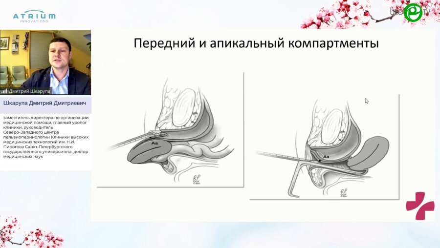 Шкарупа Д.Д. - Аксиальная фиксация в хирургии тазового дна: новая парадигма?