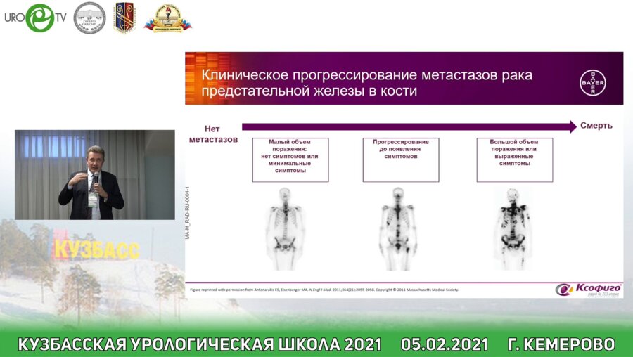 Усынин Е.А. - Возможности системной радиотерапии в лечении больных метастатическим раком предстательной железы