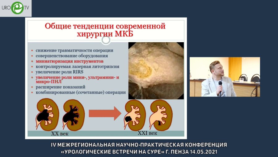 Мартов А.Г. - Микроперкутанная лазерная нефролитотрипсия