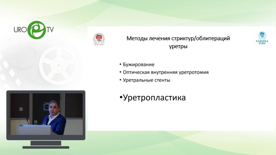 Казихинуров Р.А. - Новый подход в пересечении спонгиозного тела при уретропластике
