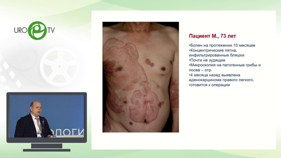 Львов А.Н. - Дермадромы – как индикатор соматического здоровья