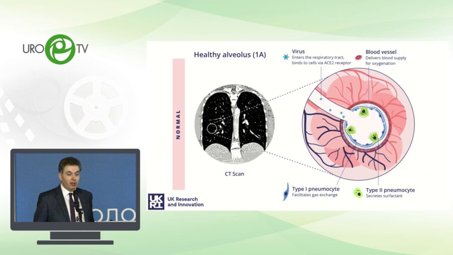Мацкеплишвили С.Т. - Спорные вопросы протокола лечения SARS-СoV 2
