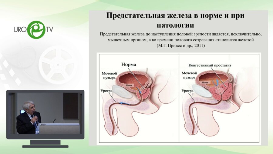 Кузьмин М.Д. - Дисфункция предстательной железы – абактериальный простатит. Новый подход к пониманию патогенеза и к лечению