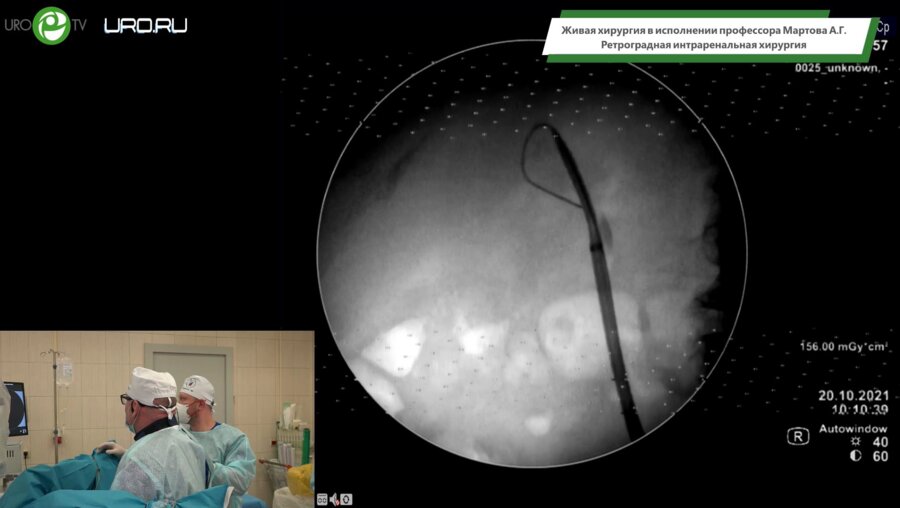 Мартов А.Г. - Ретроградная интраренальная хирургия