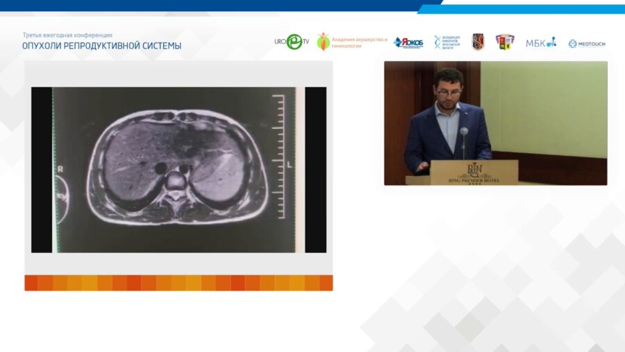 Холтобин Д.П. - Лапароскопическая адреналэктомия при раке надпочечника