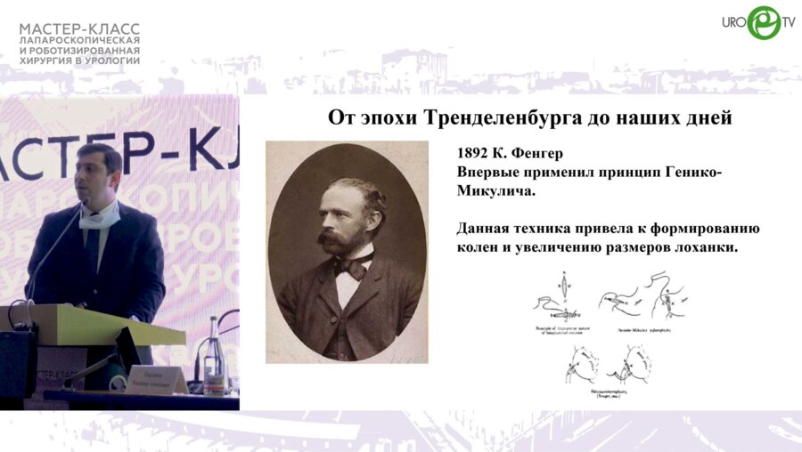Палагута Г.А. - Гидронефроз. Эволюция в лечении
