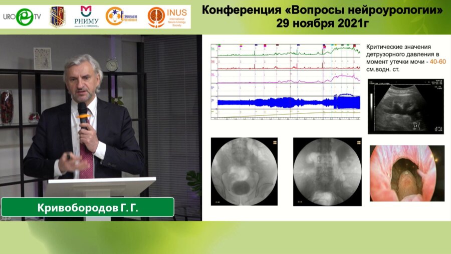 Кривобородов Г.Г. - Ботулинотерапия в комплексном лечении детрузорно-сфинктерной диссинергии
