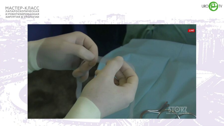 Филимонов В.Б. - TVT-O