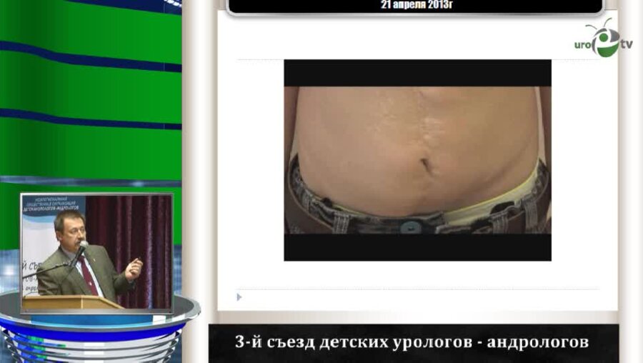 Павлов А.Ю. "Проблемы декретированного контингента детей с нарушениями мочеиспускания"