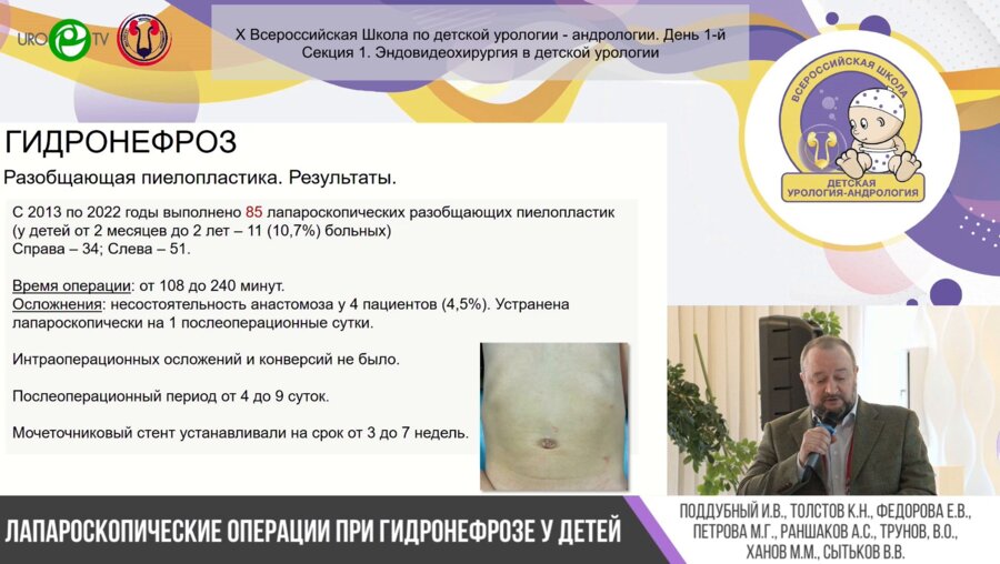 Секция 1. Эндовидеохирургия в детской урологии. I часть