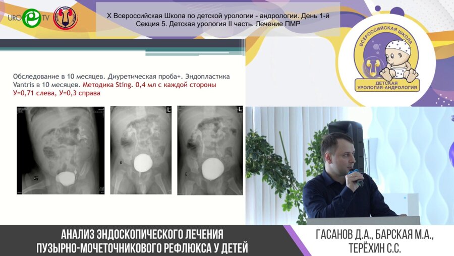 Секция 5. Детская урология II часть. Лечение ПМР