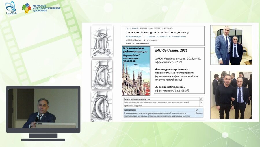 Казихинуров Р.А. - Dorsal free graft urethroplasty