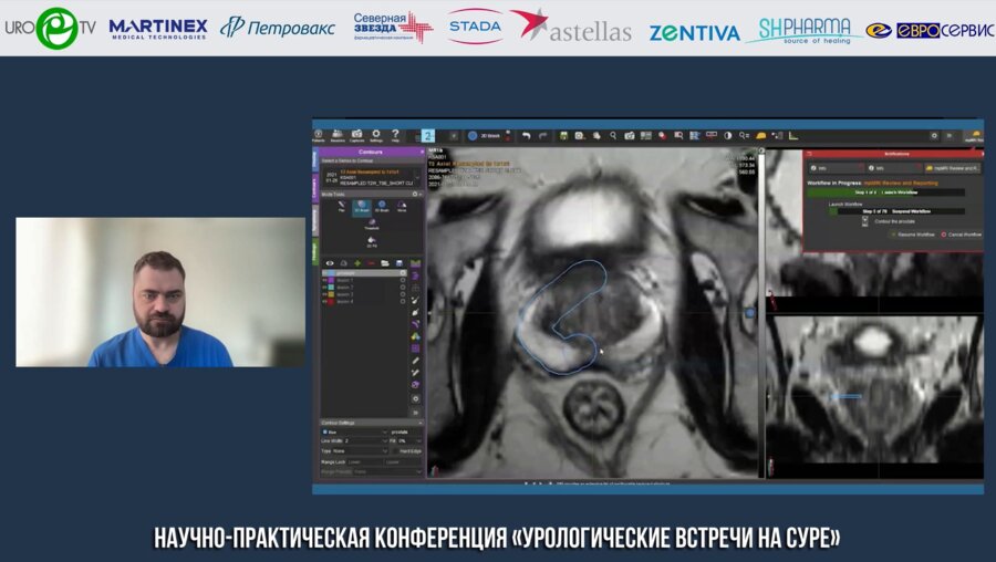 Корякин А.В. - Semi-Life Методика Фьюжн-биопсии предстательной железы