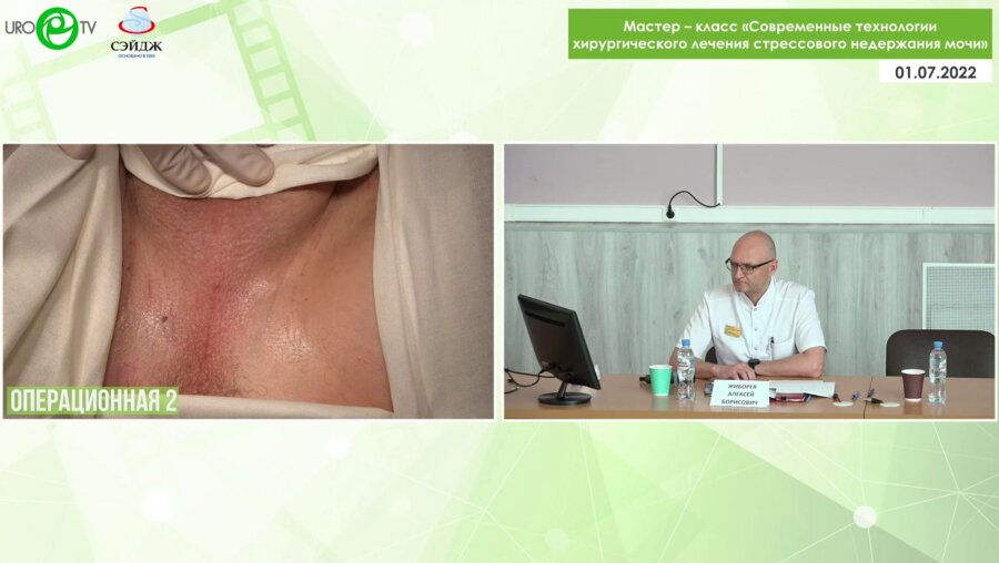 Операция 4. Слинг уретры у пациента со стрессовым недержанием мочи