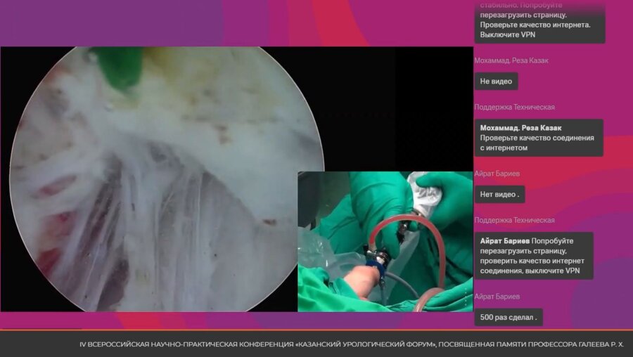 Операция 1. Бурлака О.О. - HoLEP (лазерная гольмиевая энуклеация простаты)