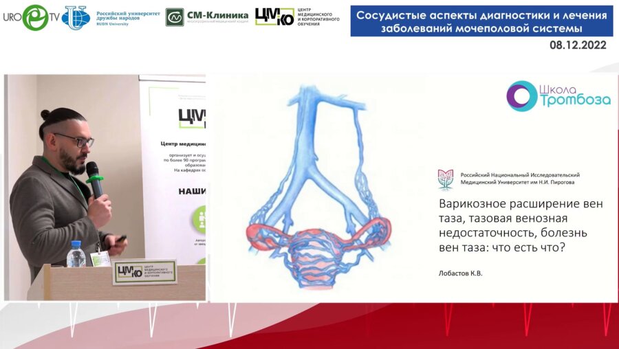 Лобастов К.В. - Варикозное расширение вен таза, тазовая венозная недостаточность, болезнь вен таза. Что есть что?