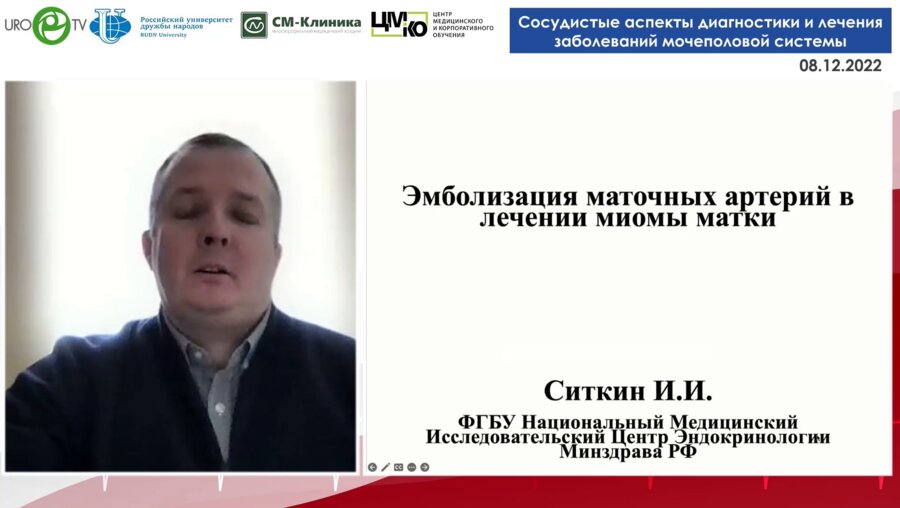 Ситкин И.И. - Эмболизация маточных артерий в лечении миомы матки