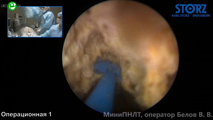 Белов В.В. - МиниПНЛТ