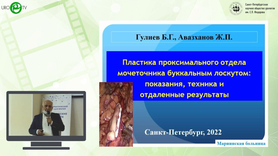 Б.Г. Гулиев, Ж.П. Авазханов - Пластика проксимального отдела мочеточника буккальным лоскутом: показания, техника и отдаленные результаты.mp4