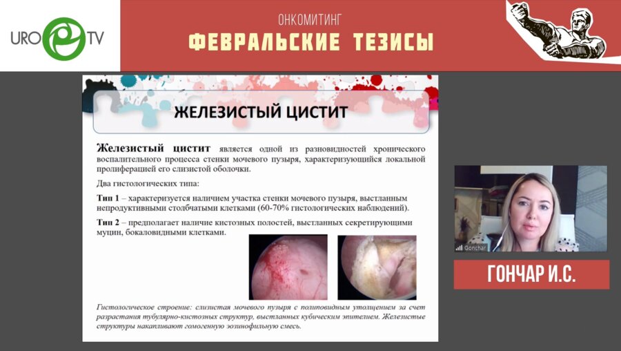 Гончар И.С. - Редкие случаи метаплазии мочевого пузыря