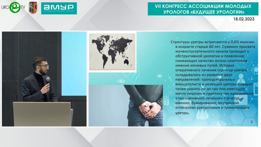 Мустафаев Д.Р. - Наш опыт лечения протяженных стриктур уретры методом буккальной пластики
