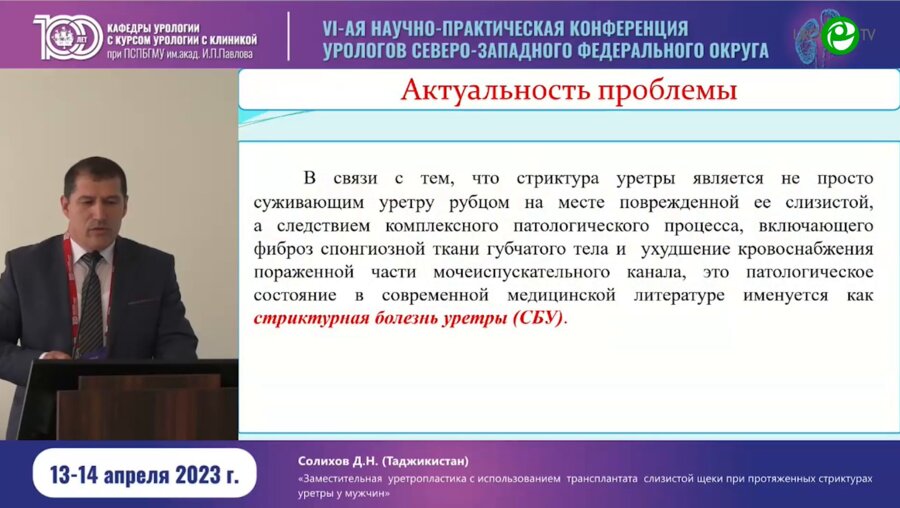 Солихов Д.Н. - Заместительная уретроплатика с исп. трансплантата слизистой щеки при протяжённых стриктурах уретры у мужчин