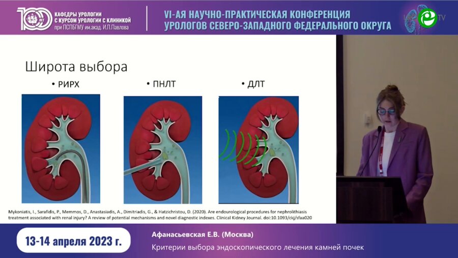 Афанасьевская Е.В. - Критерии выбора эндоскопического лечения камней почек