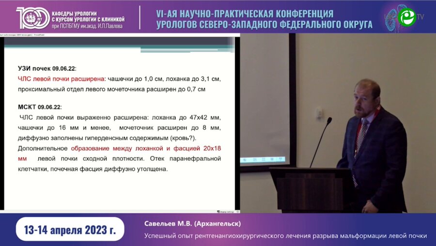 Савельев М.В. - Успешный опыт рентгенохирургического лечения разрыва мальформации левой почки