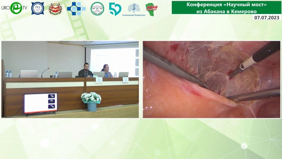 Безруков Е.А. - Лапароскопическая аденомэктомия