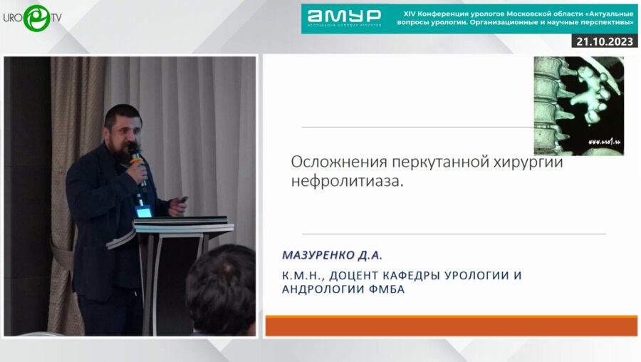 Мазуренко Д.А. - Осложнения перкутанной хирургии нефролитиаза