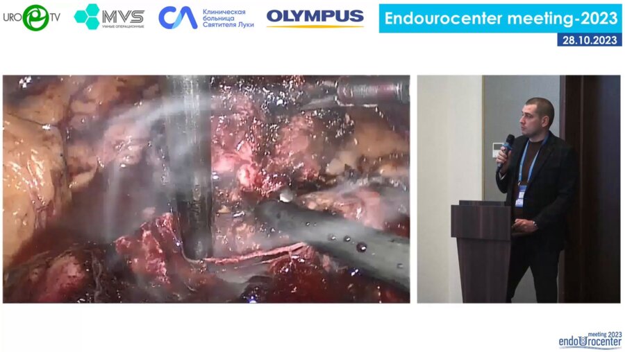 День 2. Зал «САНКТ-ПЕТЕРБУРГ» Сессия «ОНКОУРОЛОГИЯ. РАК ПОЧКИ»