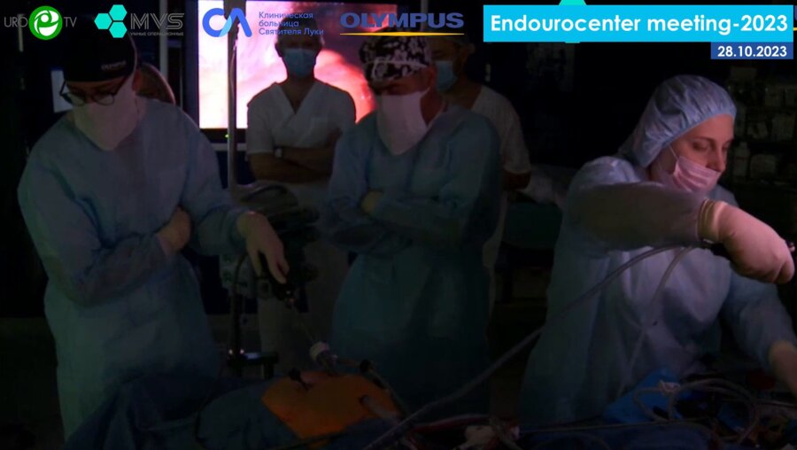 Кочкин А.Д.  - Лапароскопическая простатэктомия. Техника с сохранением ретциева пространства