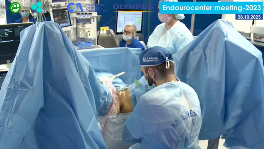 Малевич С.М. - Трансперинеальная FUSION биопсия предстательной железы на Urofusion, MyLab Esaote