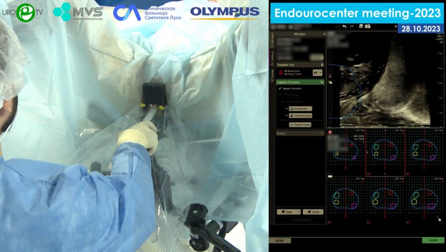 Корякин А.В. - Трансперинеальная фьюжн-биопсия стабилизированным методом на bkFusion