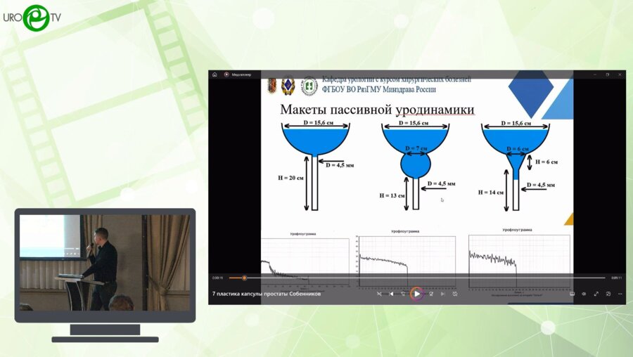Собенников И.С. - Способ позадилонной аденомэктомии с гофрирующей пластикой капсулы предстательной железы в лечении ДГПЖ