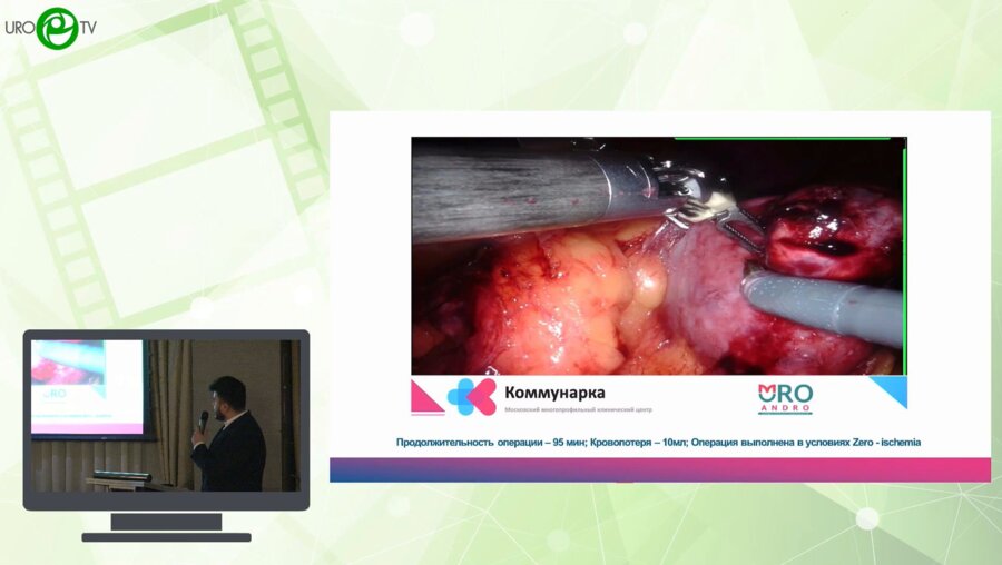 Котов С.В., Тызьо Д.В., Кобзев Д.С., Юсуфов А.Г., Гуспанов Р.И., Мещанкин И.В., Пироженко Г.А. - Хирургия единственной почки