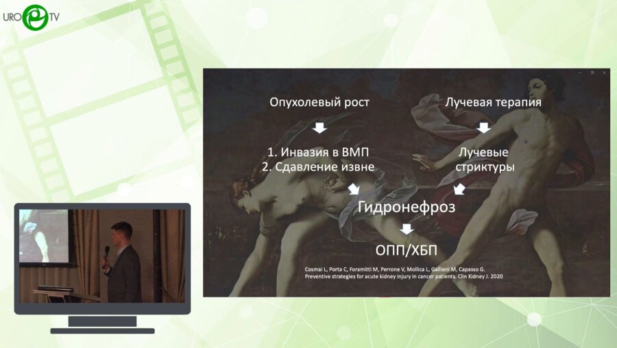 Глинин К.И. - Тандемное стентирование мочеточника. Кому и как?