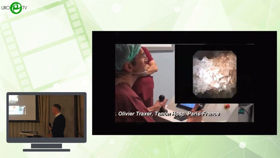 Еременко С.Н.., Еременко А.Н., Мартов А.Г., Долгополов В.П., Симонович А.В., Алиев М.А. - Робот-ассистированная пиелолитотрипсия