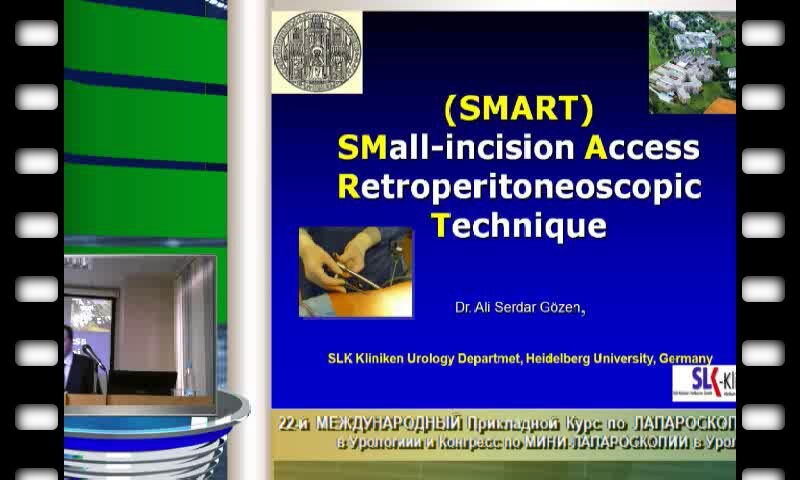 Али Сердар Гёзен  "Забрюшинная мини-лапароскопия (SMART-техника)"