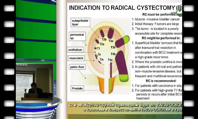 Владимир Медведев "Лапароскопическая цистпростатэктомия тонкости"