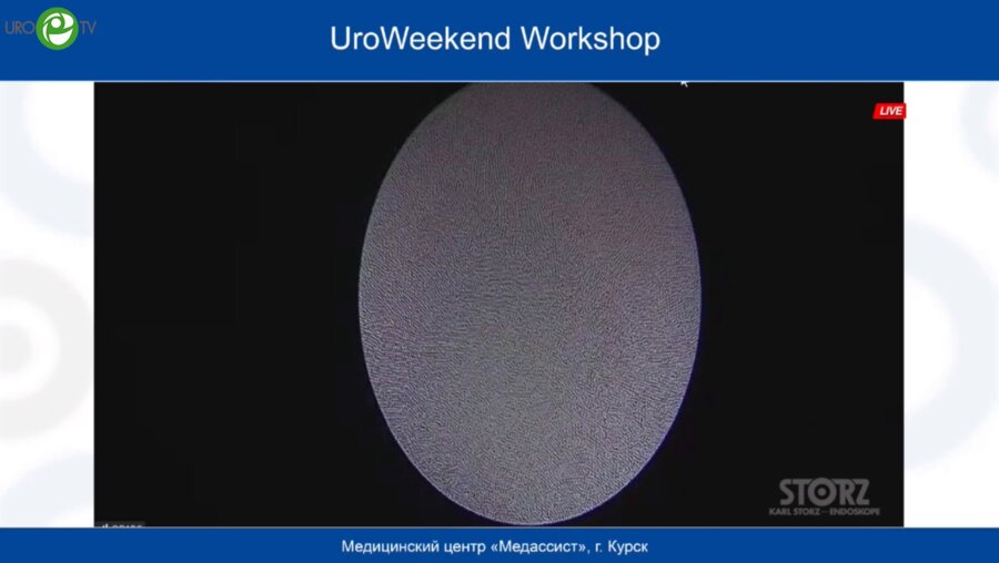 Малхасян В.А. - Ретроградная интраренальная хирургия